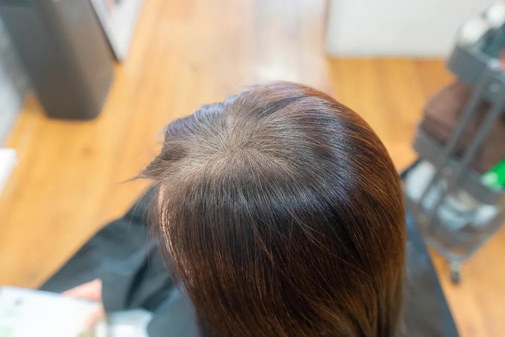 ヘナ履歴白髪染め施術前青み残り分け目白髪