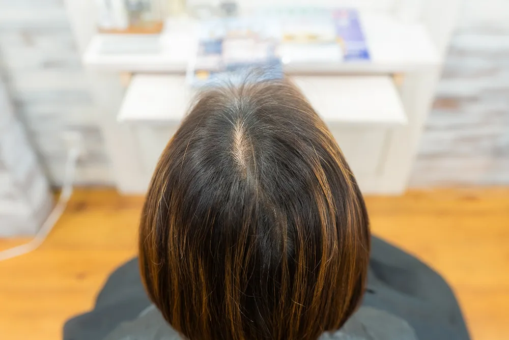 白髪分け目ゼロタッチカラー施術前40代白髪染め